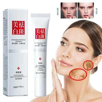 Fades Freckle Dark Spots Face Cream Niacinamide Whitening Cream Vitamin E Improve Dullness Fast Brighten Nourish Skin Care